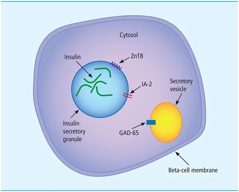 Pancreatic autoantibodies: who to test and how to interpret the results ...