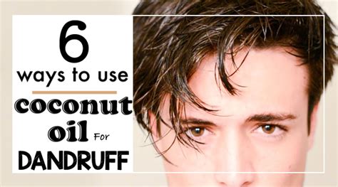 6 Ways to Use Coconut Oil for Dandruff - Getinfopedia.com