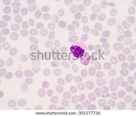 Malaria Parasite Images - Search Images on Everypixel