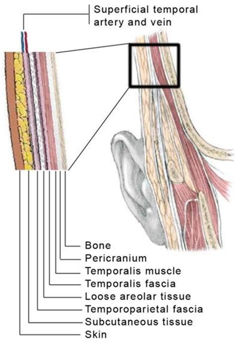 The Versatile Use of Temporoparietal Fascial Flap