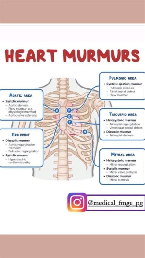 Types of shock nursing – Artofit