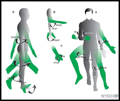 Dermatomes and Myotomes - Shoulder