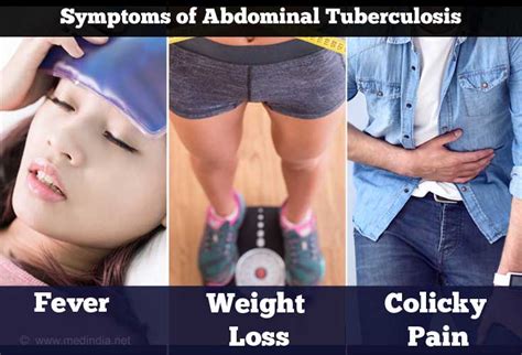 Stomach / Intestinal / Abdominal Tuberculosis - Causes, Symptoms ...