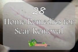 28 Home Remedies for Scar Removal - Home Remedies