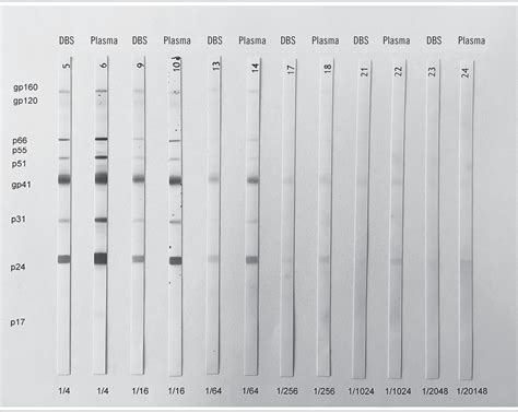 SciELO - Brasil - Performance validation of western blot for anti-HIV ...