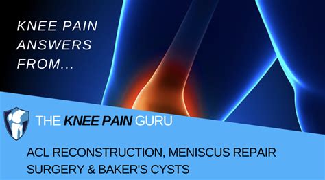 Bakers Cyst Treatment - The Knee Pain Guru