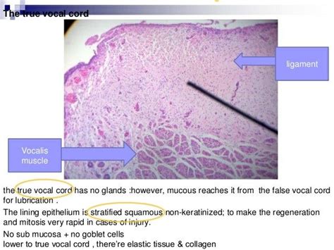 False Vocal Cords Histology