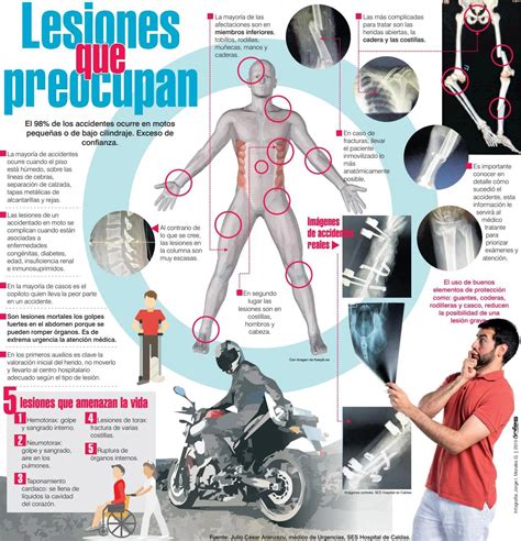 Lesiones Comunes En Caídas De Motocicleta: Tutorial De Prevención | Full Time Motos