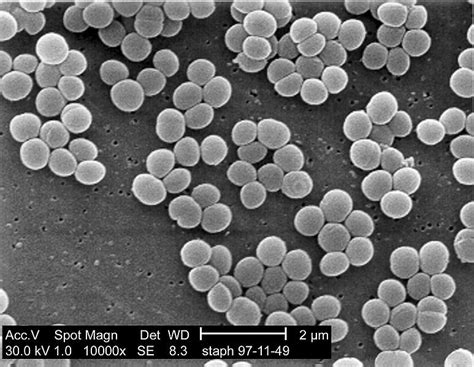 Microscope World Blog: Staphylococcus Under the Microscope