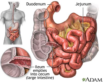 Small intestine: MedlinePlus Medical Encyclopedia Image