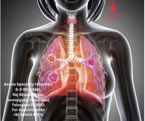 Understanding Stage 4 Lung Cancer Symptoms - Asvins Specialty Hospitals