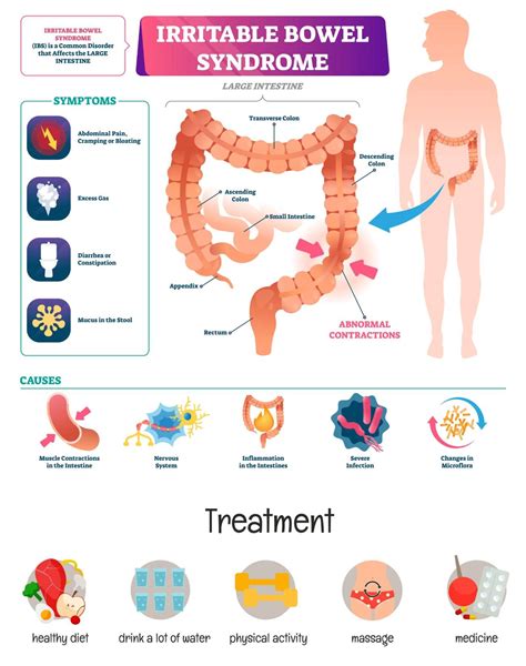 Irritable Bowel Syndrome - Amanath Clinic