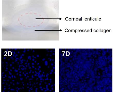 Frontiers | Development of corneal lenticule-reconstituted collagen ...