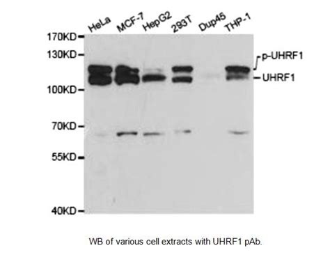 Anti-UHRF1 Antibody | Rabbit anti-Human Polyclonal IF,IHC,IP,WB | LSBio