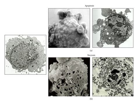 Distinct morphological features of apoptosis and necroptosis. (a ...