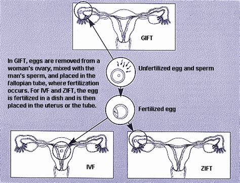 Other Assisted Reproductive Technologies - Physician in Weston, FL