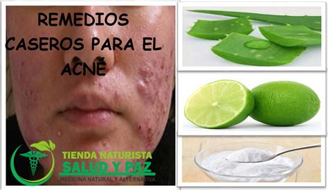 Remedios Caseros Para El Acné - Tienda naturista salud y paz