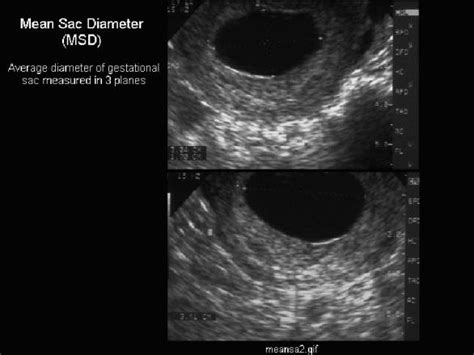 yolk sac size chart