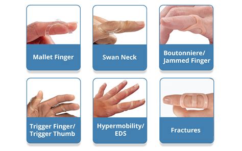 The Original Oval-8 Finger Splints | 3-Point Products