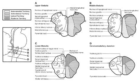 Figure 1 from Medial medullary stroke | Semantic Scholar