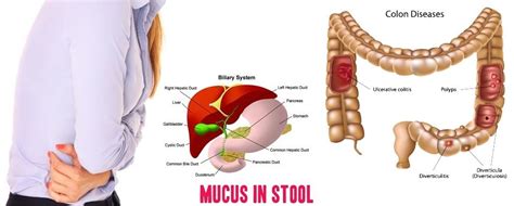 Pin on Digestive System