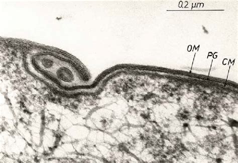 Thin section of the cell envelope of Pantoea agglomerans (strain ...