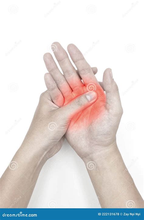 Burning Sensation In Palm Of Asian Young Man With Diabetes. Concept Of ...