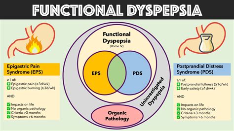 Dyspepsia: Symptoms, causes treatments with homeopathic medicine