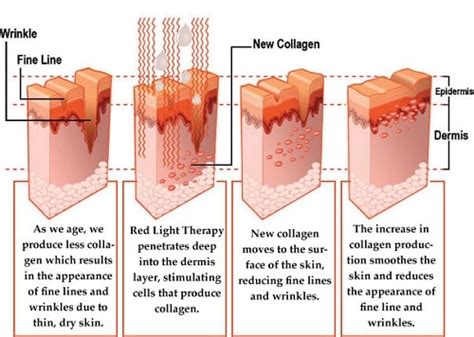 Red Light Therapy for the Skin: 4 Astonishing (Proven) Benefits