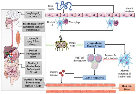 Vaccines | Free Full-Text | Ebola Virus Disease Vaccines: Development, Current Perspectives ...