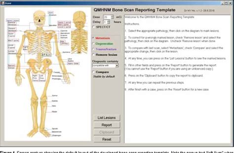 Figure 1 from Diagram-based Reporting of Bone Scintigraphy | Semantic ...