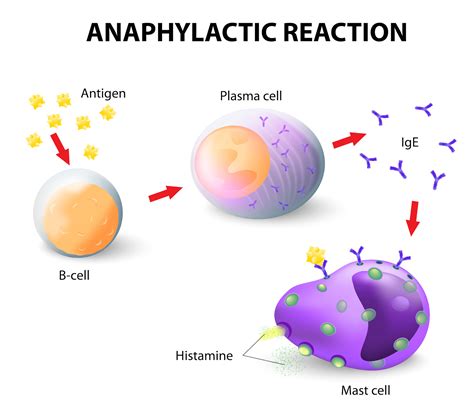 Estrogen Worsens Life-Threatening Allergic Reactions | thirdAGE | healthy living for women ...