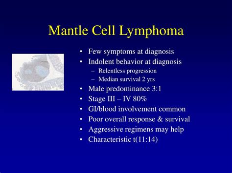 PPT - Lymphoma Presentation and Diagnosis PowerPoint Presentation, free download - ID:686254