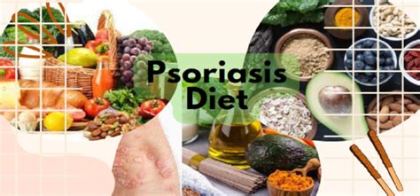 Psoriasis Diet - Overview, Foods, and Benefits - All Simple Healthy