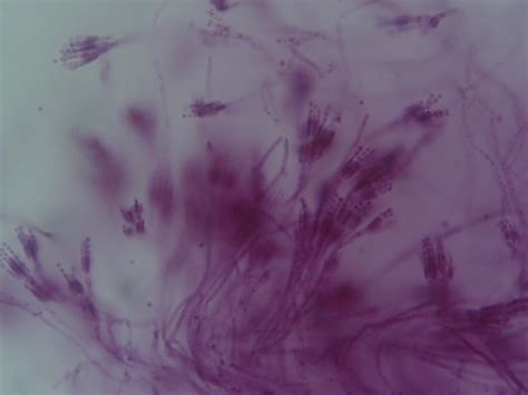 Penicillium Roqueforti Microscope