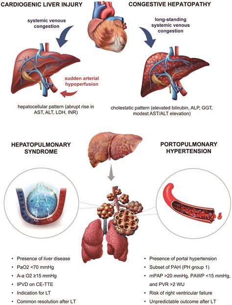 Cardiac Syndromes in Liver Disease: A Clinical Conundrum