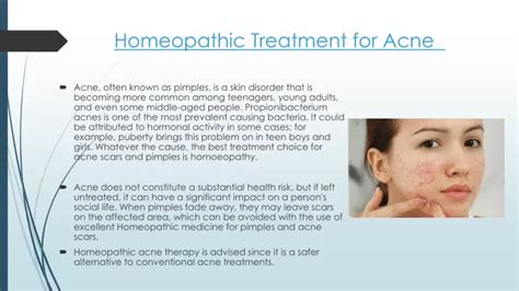 PPT - Homeopathy for Acne Treatment PowerPoint Presentation, free download - ID:11543083