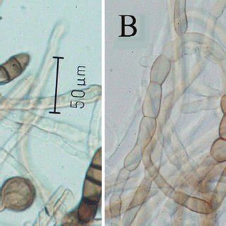 Formation of chlamydospores on PDA medium under dark conditions by... | Download Scientific Diagram