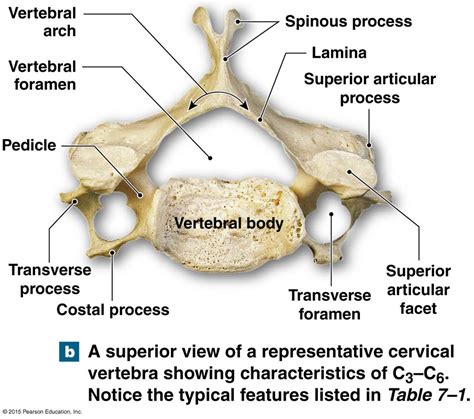 Major components of a typical vertebrae and the vertebral canal. | Basic anatomy and physiology ...