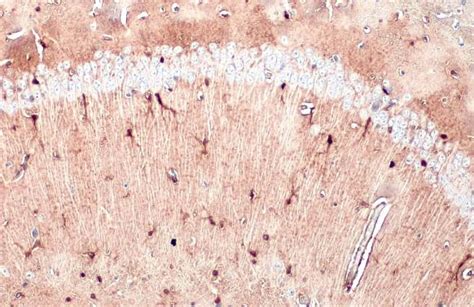 S100B Polyclonal Antibody (PA5-78161)