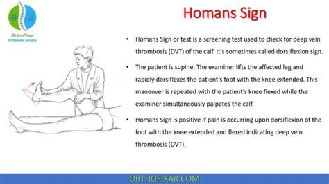 Homans Sign A Complete Overview - E Phlebotomy Training