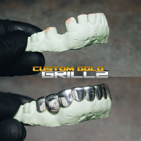 Buy Custom-Fit Solid Sterling Silver Grillz - Custom Gold Grillz