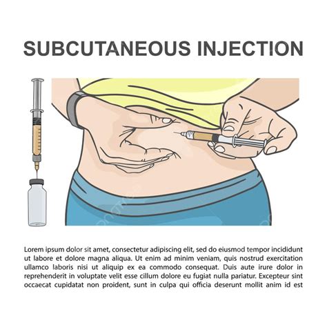 Gambar Injeksi Subkutan Dalam Ilustrasi Vektor Medis Perut Templat ...