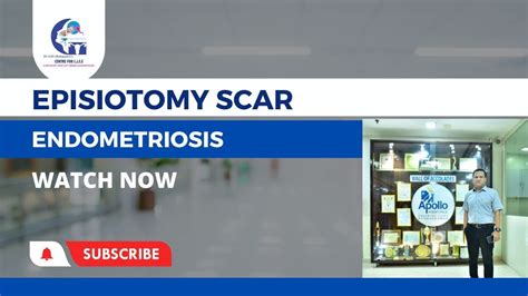 EPISIOTOMY SCAR ENDOMETRIOSIS : DR G S S MOHAPATRA - YouTube