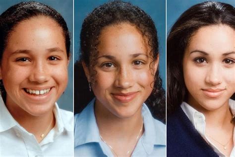 Unpublished photos of Meghan Markle before her surgeries are leaked