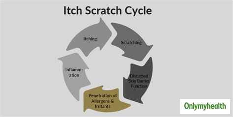 Do You Know Why You Itch A Lot Sometimes? Understand The ‘Itch-Scratch ...