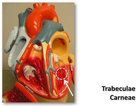 Trabeculae carneae - The Anatomy of the Heart Visual Atlas… | Flickr