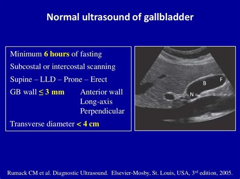 Ultrasound of the gallbladder