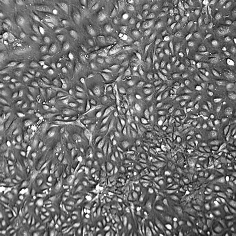 HUVEC 10-Donor Human Umbilical Vein Endothelial Cells