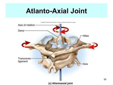 Pictures Of Atlas Axis Joint